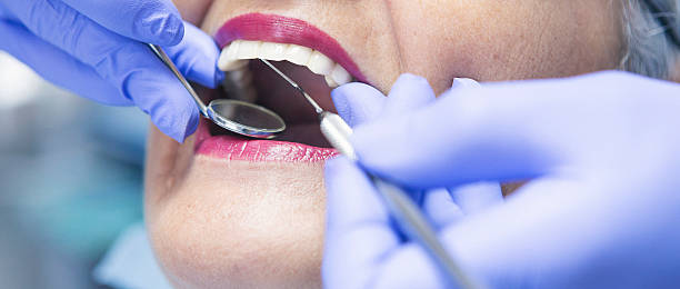Best Knocked-Out Tooth Emergency  in Prescott Valley, AZ